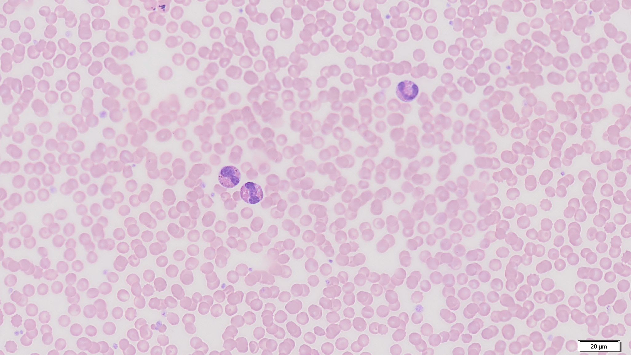 Eosinophile